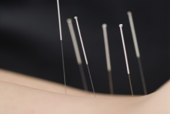 Conscious Health in Sandgate for Acupuncture Treatments